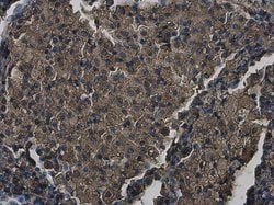 Invitrogen ZC3HAV1 Polyclonal Antibody 100 &mu;L; Unconjugated:Antibodies,