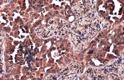 Invitrogen ZC3HAV1 Polyclonal Antibody 100 &mu;L; Unconjugated:Antibodies,