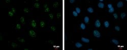 Invitrogen RSRP1 Polyclonal Antibody 100 &mu;L; Unconjugated:Antibodies,