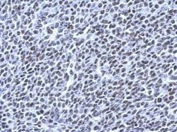 Invitrogen RSRP1 Polyclonal Antibody 100 &mu;L; Unconjugated:Antibodies,