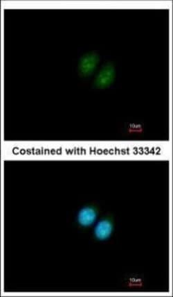 Invitrogen RRP12 Polyclonal Antibody 100 &mu;L | Buy Online | Invitrogen&trade; | Fisher Scientific