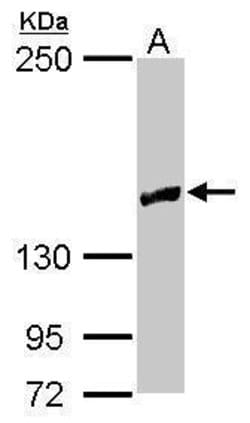 Invitrogen RRP12 Polyclonal Antibody 100 &mu;L | Buy Online | Invitrogen&trade; | Fisher Scientific