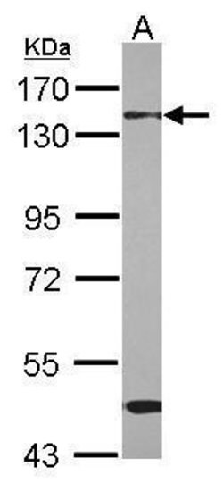 Invitrogen RBM26 Polyclonal Antibody 100 &mu;L | Buy Online | Invitrogen&trade; | Fisher Scientific