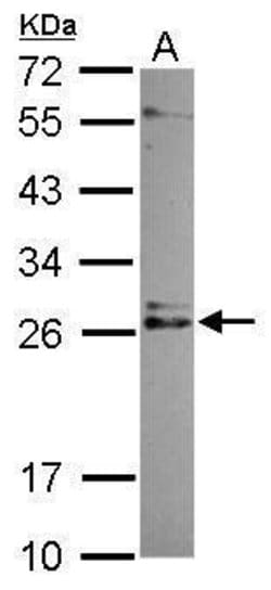 Invitrogen IMP3 Polyclonal Antibody 100 μL; Unconjugated:Antibodies,