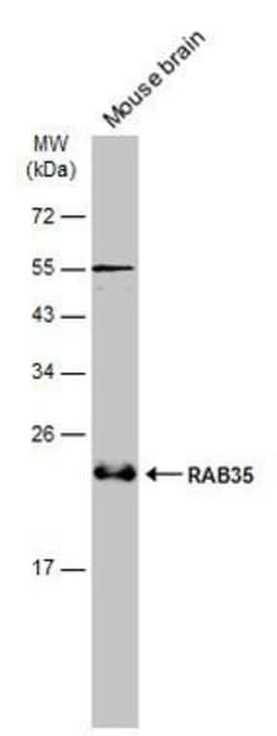 Invitrogen RAB35 Polyclonal Antibody 100 &mu;L; Unconjugated:Antibodies,