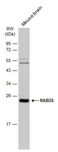 Invitrogen RAB35 Polyclonal Antibody 100 &mu;L; Unconjugated:Antibodies,