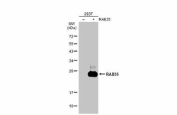 Invitrogen RAB35 Polyclonal Antibody 100 &mu;L; Unconjugated:Antibodies,