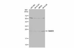 Invitrogen RAB35 Polyclonal Antibody 100 &mu;L; Unconjugated:Antibodies,