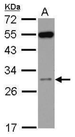 Invitrogen RPS8 Polyclonal Antibody 100 μL; Unconjugated:Antibodies,
