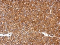 Invitrogen PGLS Polyclonal Antibody 100 &mu;L; Unconjugated:Antibodies,