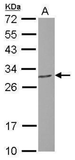 Invitrogen PGLS Polyclonal Antibody 100 &mu;L; Unconjugated:Antibodies,