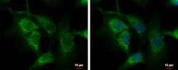 Invitrogen C1orf74 Polyclonal Antibody 100 μL; Unconjugated:Antibodies,