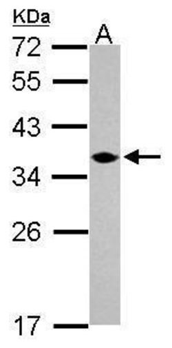 Invitrogen C1orf74 Polyclonal Antibody 100 μL; Unconjugated:Antibodies,