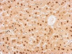 Invitrogen UPRT Polyclonal Antibody 100 μL; Unconjugated:Antibodies,