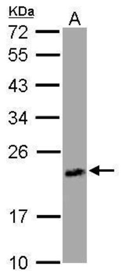 Invitrogen UPRT Polyclonal Antibody 100 μL; Unconjugated:Antibodies,