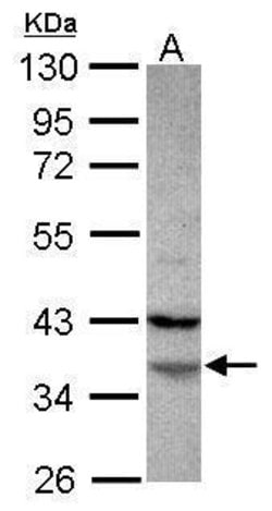 Invitrogen FAM76A Polyclonal Antibody 100 &mu;L; Unconjugated:Antibodies,