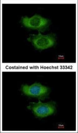 Invitrogen NAA16 Polyclonal Antibody 100 &mu;L; Unconjugated:Antibodies,