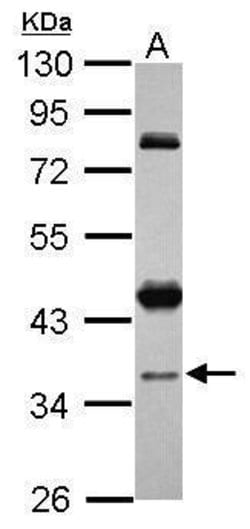Invitrogen CCDC94 Polyclonal Antibody 100 &mu;L; Unconjugated:Antibodies,