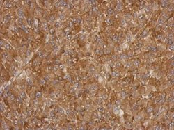 Invitrogen ACTRT1 Polyclonal Antibody 100 μL; Unconjugated:Antibodies,