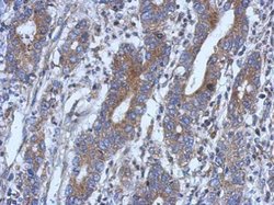 Invitrogen NSUN4 Polyclonal Antibody 100 &mu;L; Unconjugated:Antibodies,