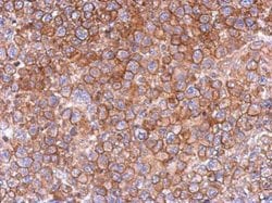 Invitrogen FCHO2 Polyclonal Antibody 100 &mu;L; Unconjugated:Antibodies,