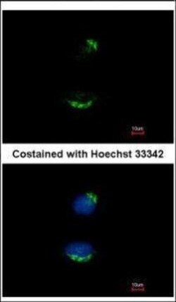 Invitrogen UBAC1 Polyclonal Antibody 100 &mu;L; Unconjugated:Antibodies,