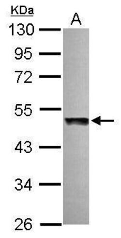 Invitrogen UBAC1 Polyclonal Antibody 100 &mu;L; Unconjugated:Antibodies,