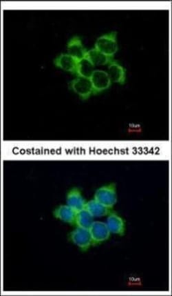 Invitrogen FUZ Polyclonal Antibody 100 &mu;L; Unconjugated:Antibodies,