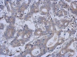 Invitrogen FUZ Polyclonal Antibody 100 &mu;L; Unconjugated:Antibodies,