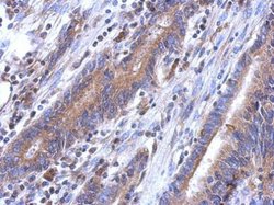 LYPLA3 Polyclonal Antibody, Invitrogen 100 &mu;L; Unconjugated:Antibodies,