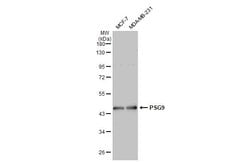 Invitrogen PSG9 Polyclonal Antibody 100 &mu;L; Unconjugated:Antibodies,