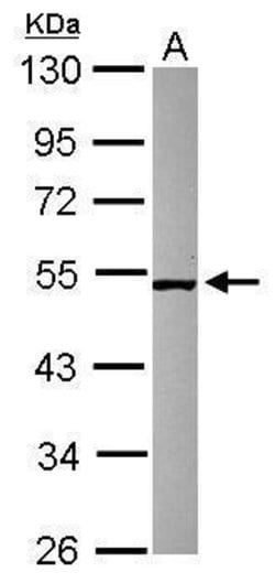 Invitrogen SMCR7 Polyclonal Antibody 100 &mu;L; Unconjugated:Antibodies,