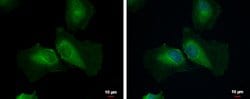 Invitrogen STAMBPL1 Polyclonal Antibody 100 μL; Unconjugated:Antibodies,