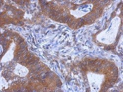 Invitrogen WDR85 Polyclonal Antibody 100 &mu;L; Unconjugated:Antibodies,