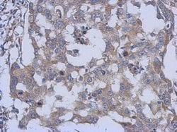 Invitrogen PARS2 Polyclonal Antibody 100 &mu;L; Unconjugated:Antibodies,