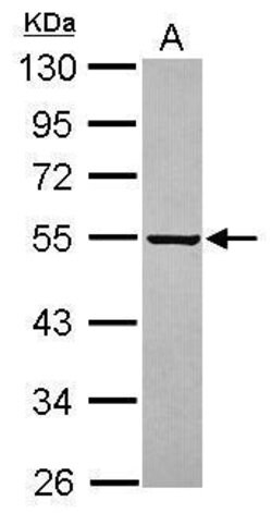 Invitrogen PARS2 Polyclonal Antibody 100 &mu;L; Unconjugated:Antibodies,