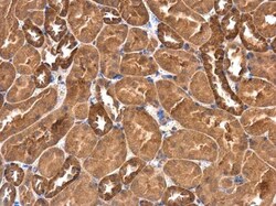 Invitrogen RASGEF1A Polyclonal Antibody 100 &mu;L; Unconjugated:Antibodies,
