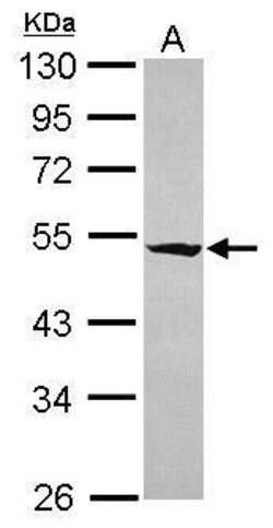 Invitrogen RASGEF1A Polyclonal Antibody 100 &mu;L; Unconjugated:Antibodies,