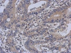 Invitrogen C14orf21 Polyclonal Antibody 100 &mu;L; Unconjugated:Antibodies,