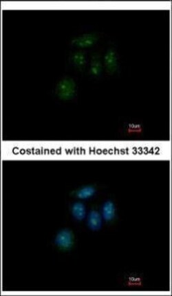Invitrogen ZFP69 Polyclonal Antibody 100 &mu;L | Buy Online | Invitrogen&trade; | Fisher Scientific