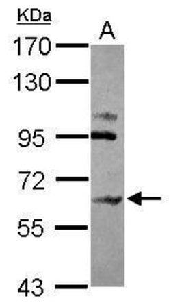 Invitrogen CHST15 Polyclonal Antibody 100 &mu;L; Unconjugated:Antibodies,