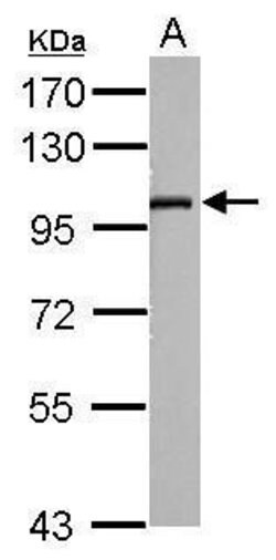 Invitrogen SLC9A8 Polyclonal Antibody 100 &mu;L; Unconjugated:Antibodies,