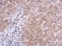 Invitrogen KLHL21 Polyclonal Antibody 100 &mu;L; Unconjugated:Antibodies,