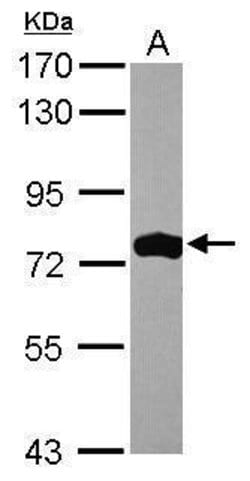 Invitrogen ASMTL Polyclonal Antibody 100 &mu;L; Unconjugated:Antibodies,