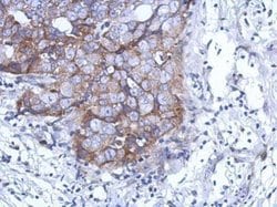 Invitrogen™ DDX59 Polyclonal Antibody