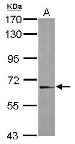Invitrogen DDX59 Polyclonal Antibody 100 &mu;L; Unconjugated:Antibodies,