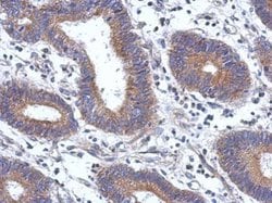 Invitrogen ENTPD7 Polyclonal Antibody 100 &mu;L; Unconjugated:Antibodies,