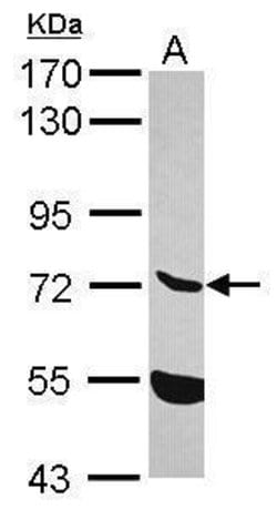 Invitrogen ENTPD7 Polyclonal Antibody 100 &mu;L; Unconjugated:Antibodies,