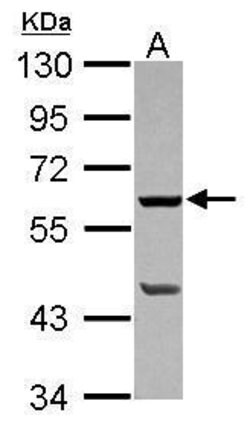 Invitrogen PLA2G4F Polyclonal Antibody 100 &mu;L | Buy Online | Invitrogen&trade; | Fisher Scientific