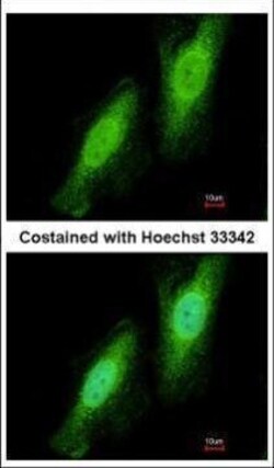 Invitrogen TRIM41 Polyclonal Antibody 100 &mu;L; Unconjugated:Antibodies,